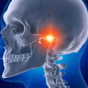 Jaw Pain. An Inflamed TMJ