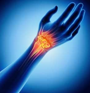 rheumatoid arthritis in the wrist