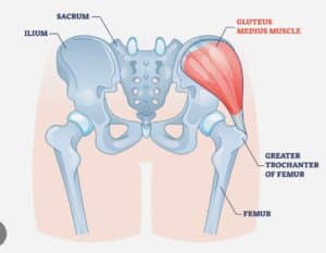 A simplified illustration of a glute muscle is displayed, indicating the affected area.