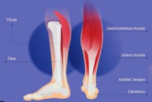 Discover the secrets to bouncing back from a calf muscle pull like never before. 