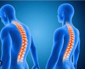 Exploring natural methods to alleviate spinal discomfort, without surgical intervention.