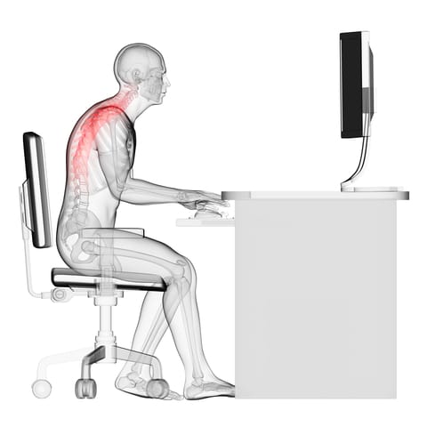 forward head posture from poor posture and its affect on the spine and surrounding structures