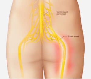 The origin of the Sciatic Nerve and the surrounding joints and muscles 