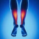 Achilles tendinopathy and its relates symptoms
