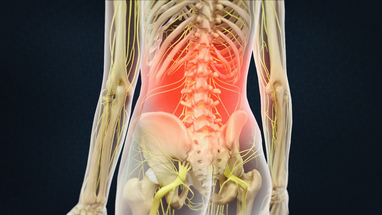 Muscle Strain and Tension