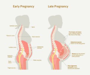 Pregnancy changes the loads placed through the spine and pelvis.